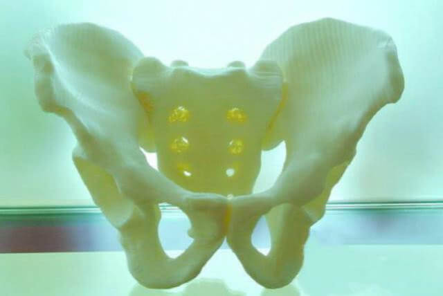 3D printing of bones 01