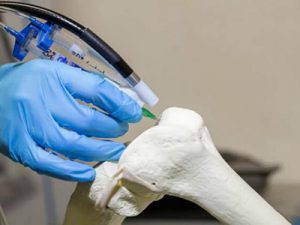 3D printing of bones 07