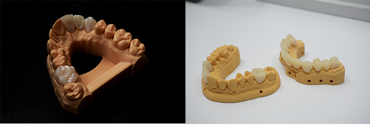 Dental 3D printer 11