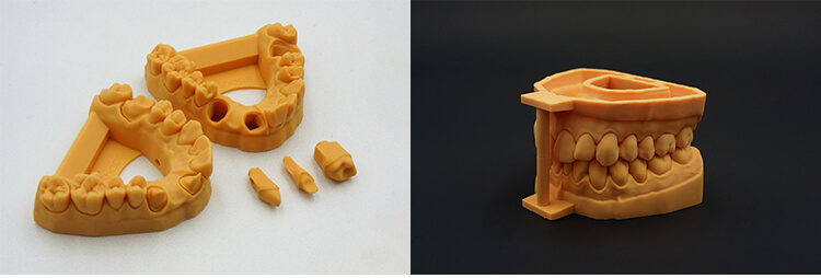 Dental 3D printer 12