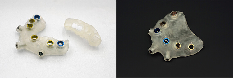 Dental 3D printer 13