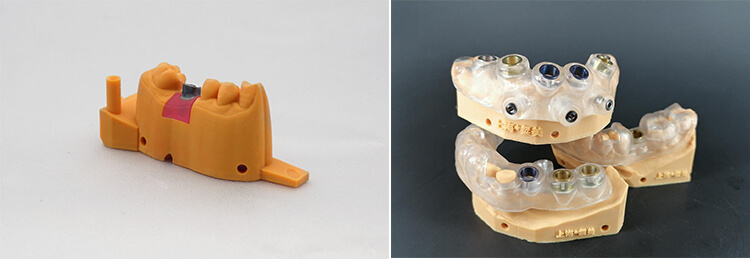 Dental 3D printer 14